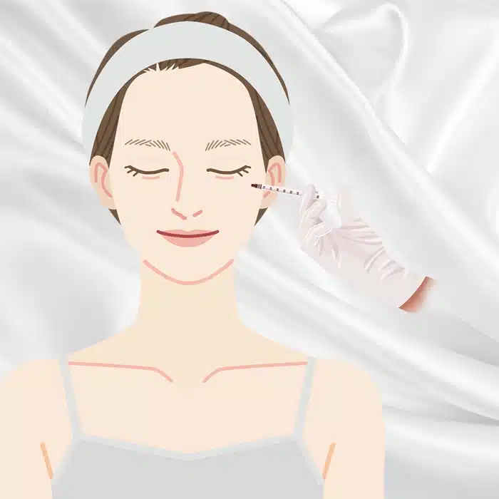 涙袋のヒアルロン酸注射