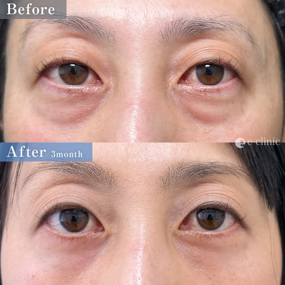 表ハムラ（名医の伊藤医師が執刀）