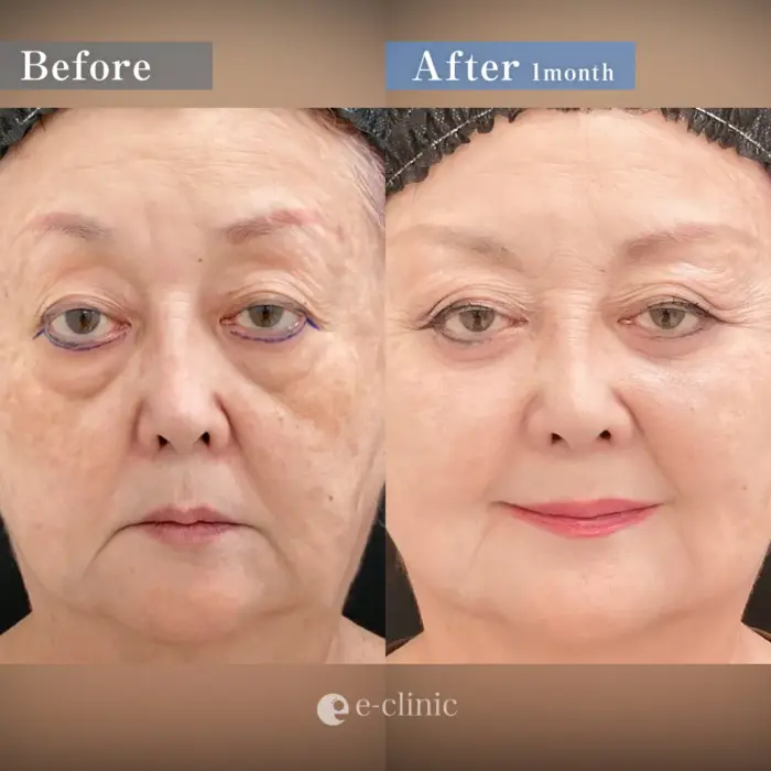 表ハムラ（名医の松浦医師が執刀）