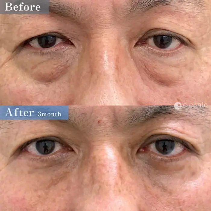 表ハムラ（名医の松浦医師が執刀）