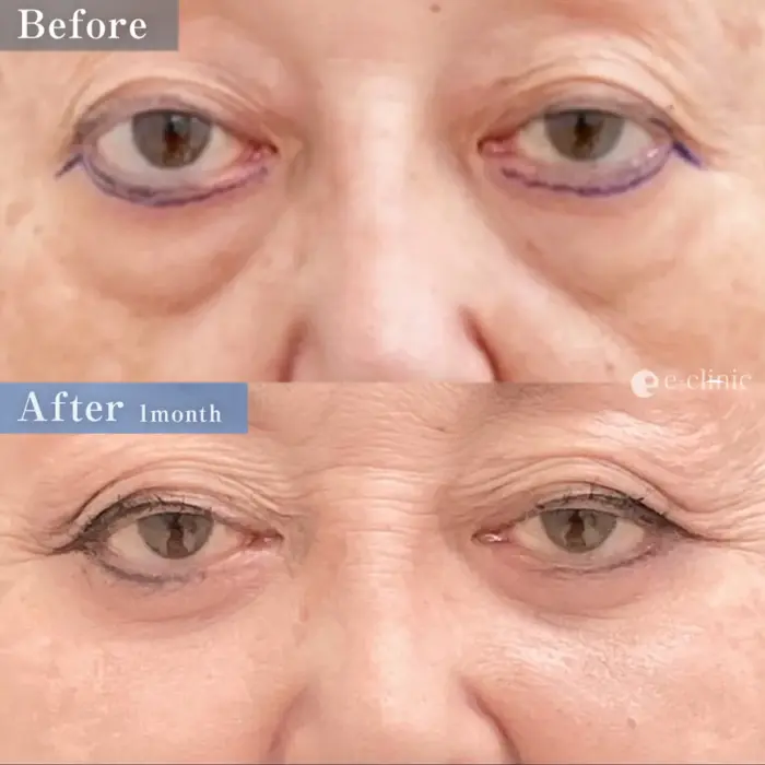 表ハムラ（名医の松浦医師が執刀）