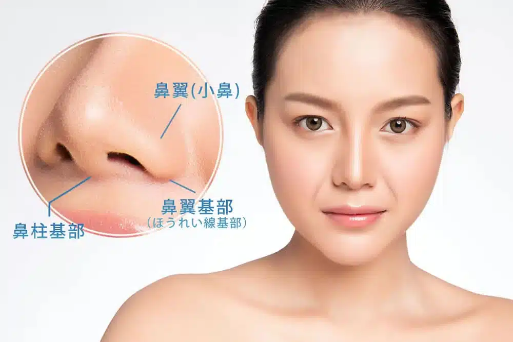 鼻翼基部の凹み