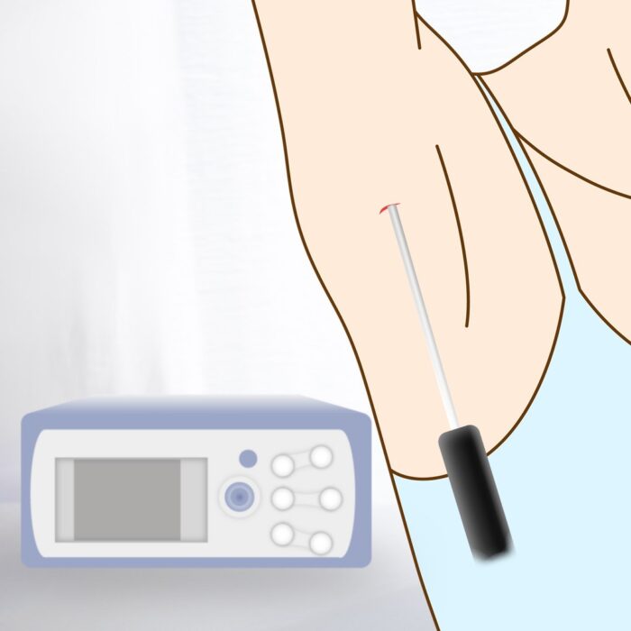 ウルトラZを使っているところ