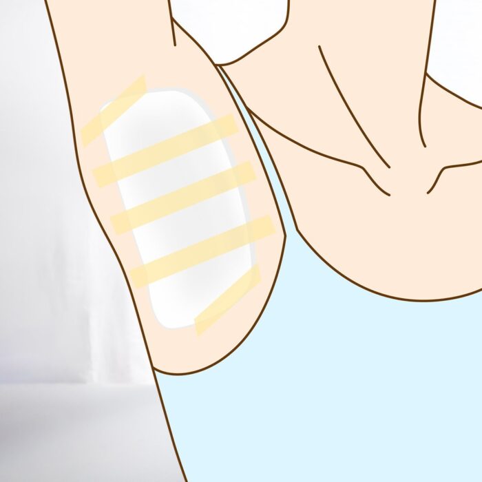 脇にガーゼを当てているところ