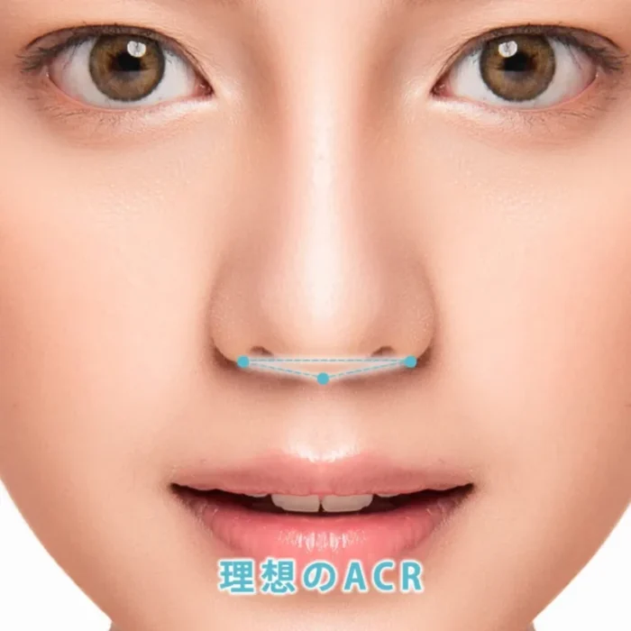 eクリニックのACRの図解