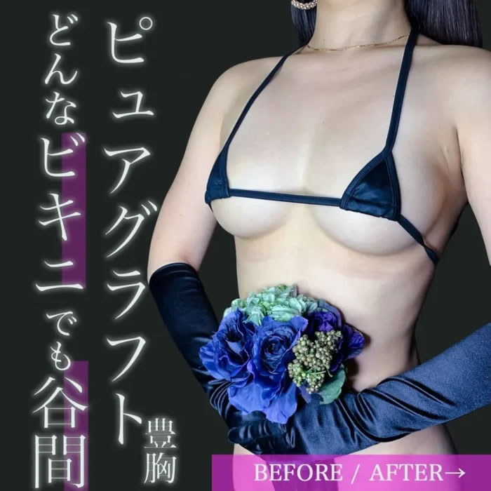 ピュアグラフとの症例写真