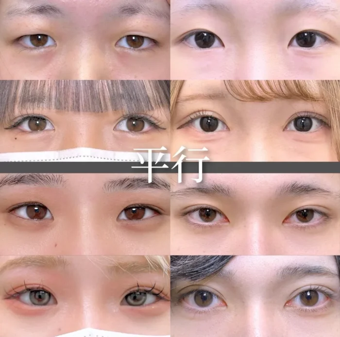 二重症例一覧のデザイン（末広平行）