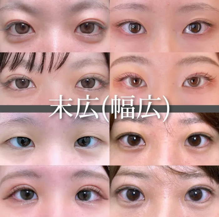 二重症例一覧のデザイン（末広幅広）