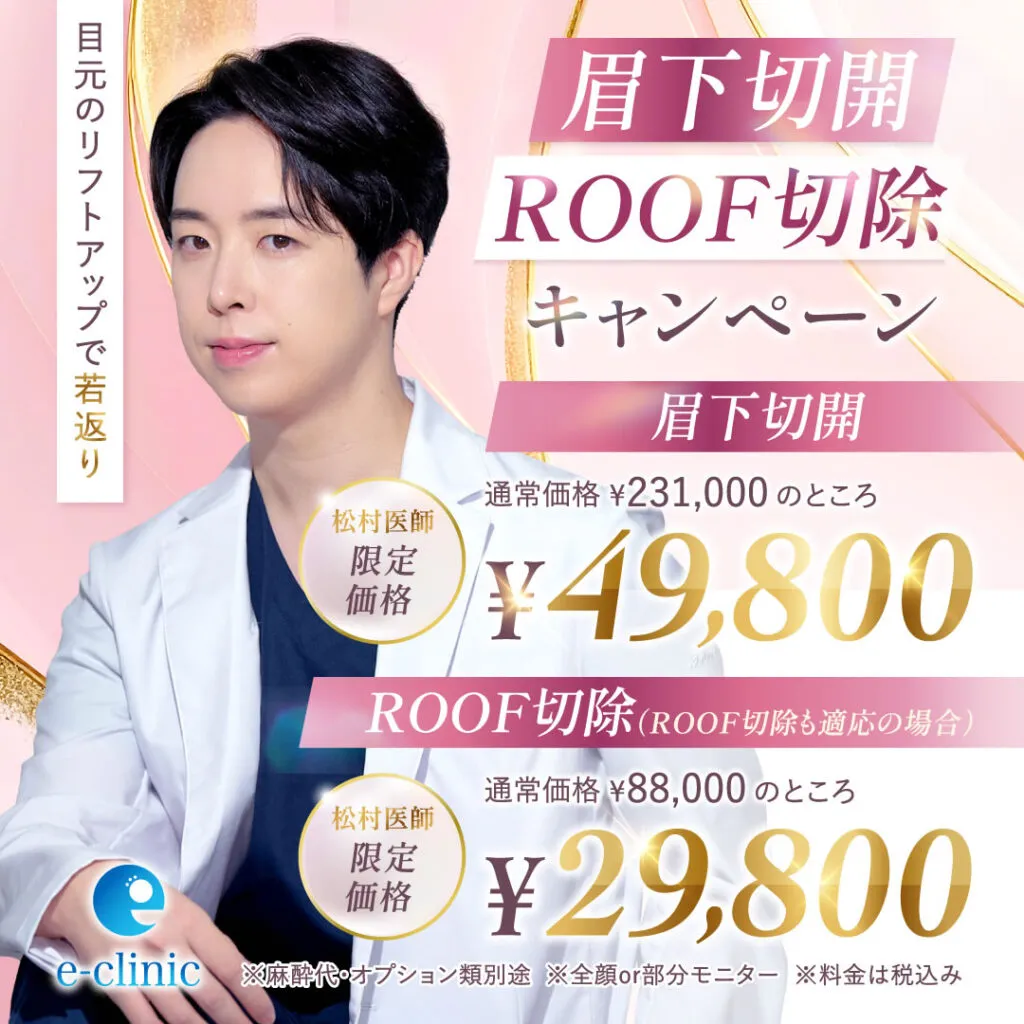 【京都院限定】松村医師の眉下切開・ROOF切除キャンペーン