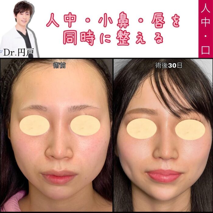 人中短縮の症例写真