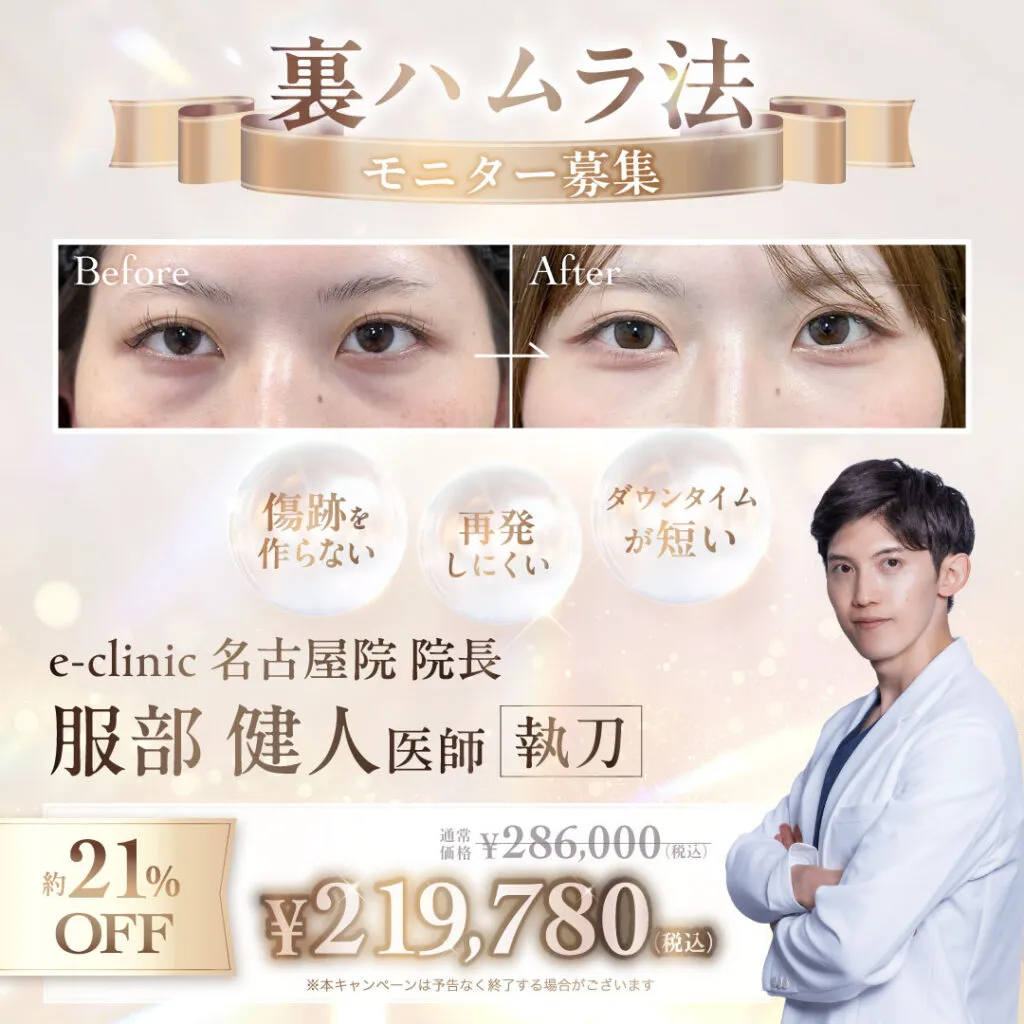 【名古屋院限定】服部医師の裏ハムラ法キャンペーン