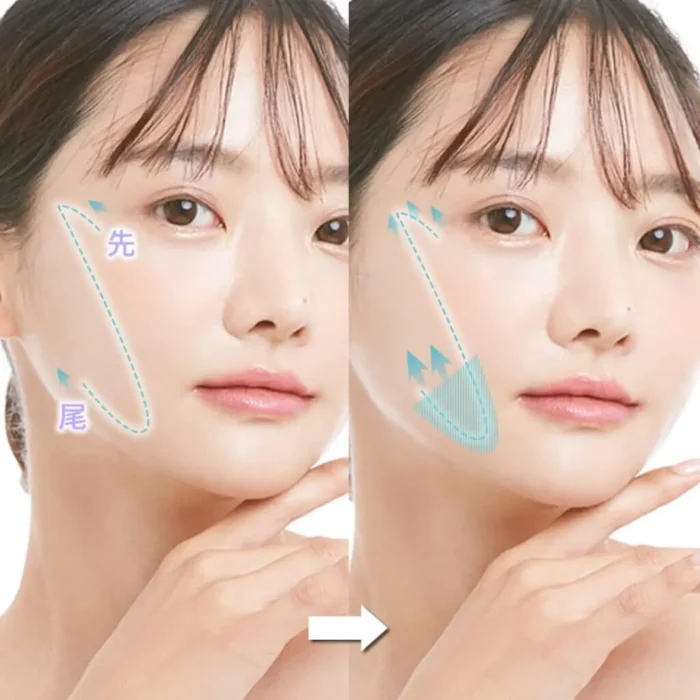 糸リフトのデザインイメージ