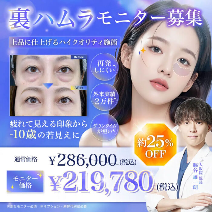 脇谷医師の裏ハムラ法のキャンペーン