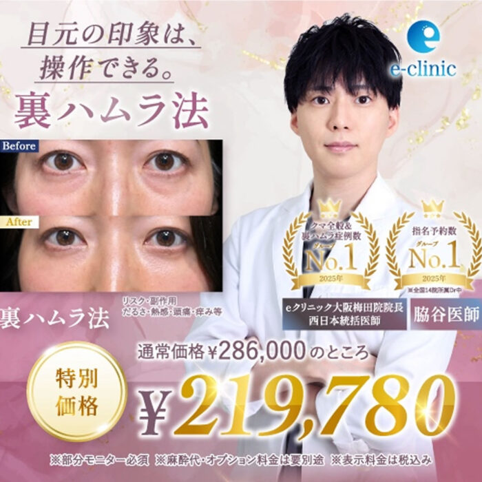 脇谷医師の裏ハムラ法のバナー