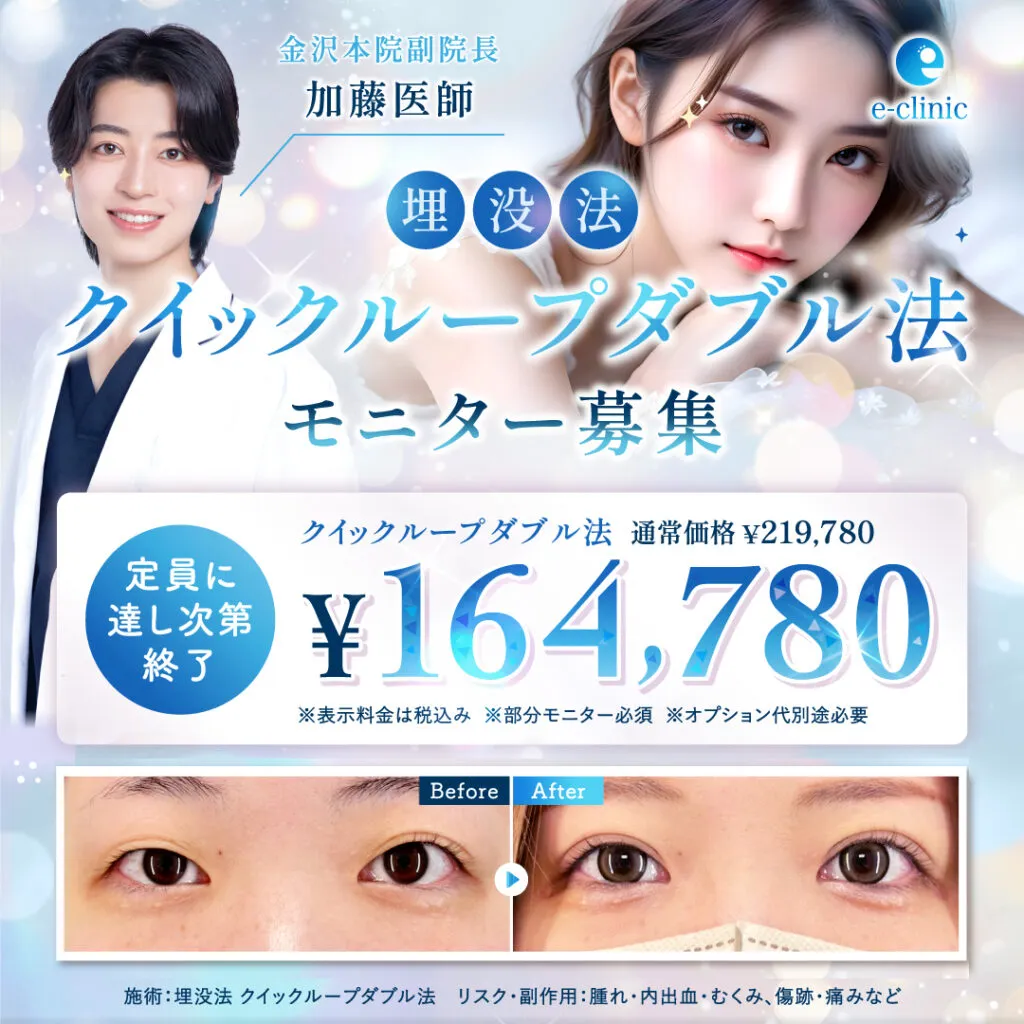 【金沢院限定】加藤医師の埋没法クイックループダブル法キャンペーン