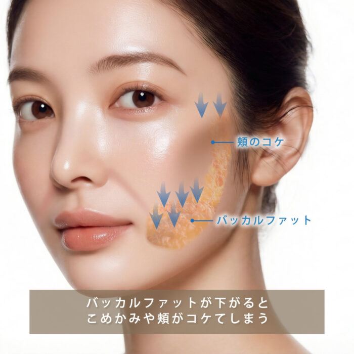 バッカルファットの下垂によりこめかみと頬がコケてしまう図解