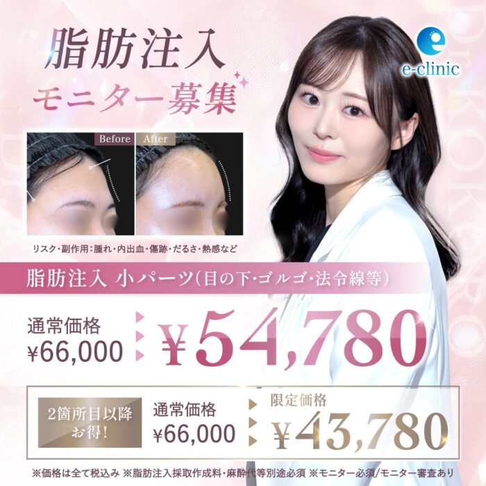 上坂 こころ医師の顔の脂肪吸引のキャンペーンバナー (3)
