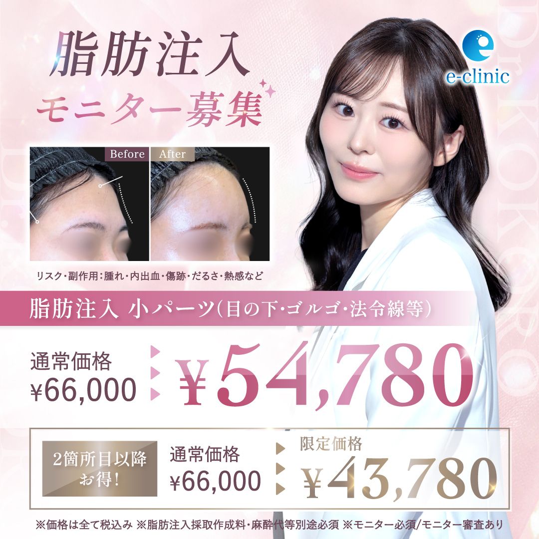 上坂 こころ医師の顔の脂肪吸引のキャンペーンバナー (3)