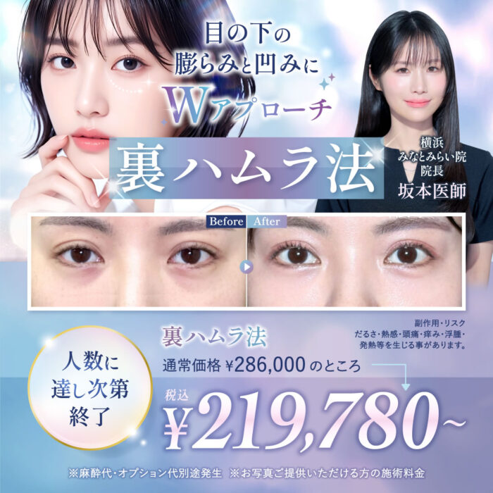 横浜みなとみらい院の坂本 優衣医師の裏ハムラ法のキャンペーンバナー (1)