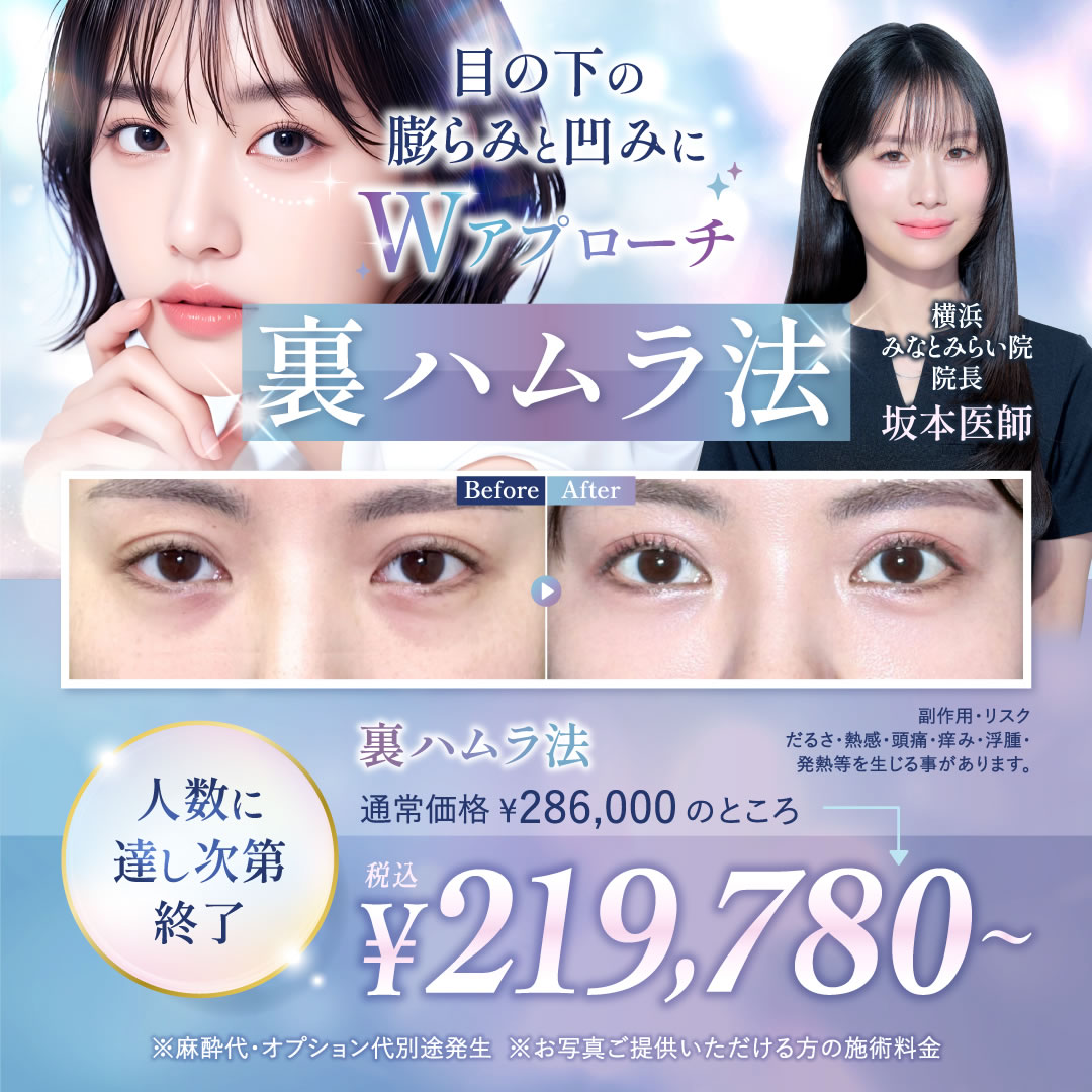 横浜みなとみらい院の坂本 優衣医師の裏ハムラ法のキャンペーンバナー (1)