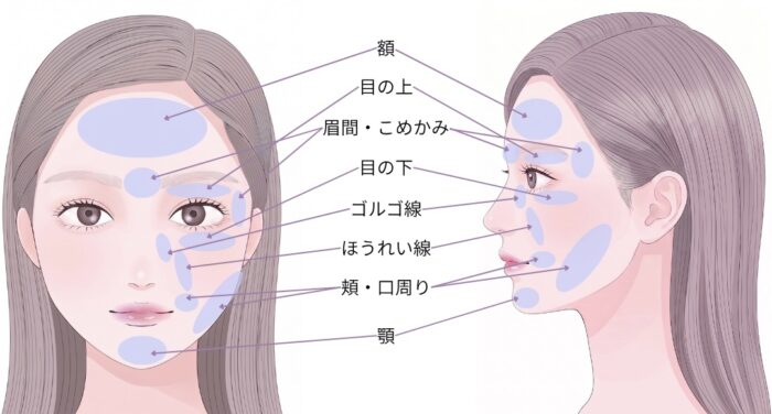 脂肪注入対象部位