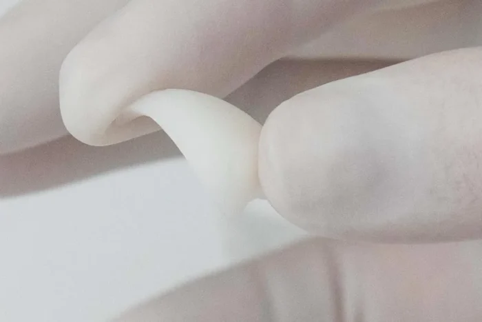 貴族手術で使用するプロテーゼ
